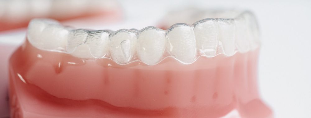 Nahaufnahme eines zahnmedizinischen Modells mit durchsichtigen Alignern, die über künstlichen Zähnen angebracht sind und eine kieferorthopädische Behandlung zur Zahnkorrektur demonstrieren. Das Modell ist aus rosa und weißem Kunststoff gefertigt.