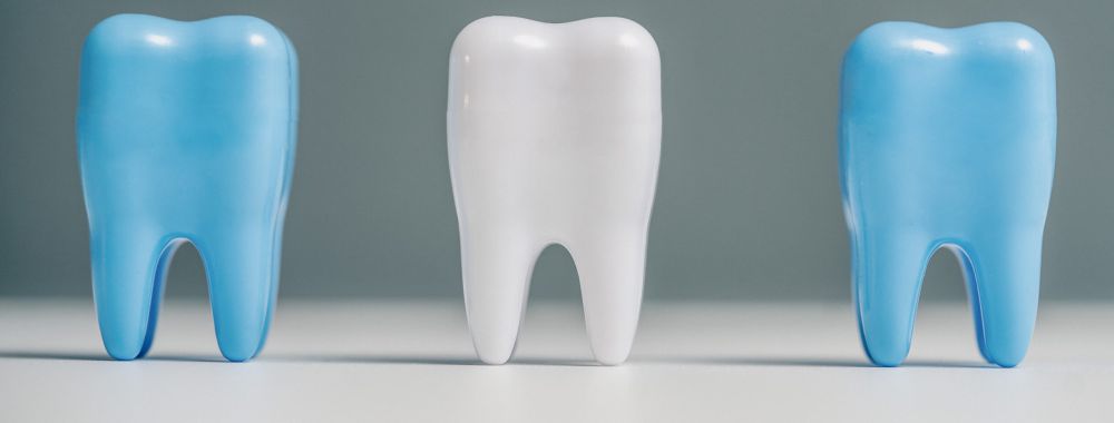 Drei zahnförmige Modelle stehen in einer Reihe auf einer weißen Fläche; das in der Mitte ist weiß, während die beiden seitlichen Modelle hellblau sind, alles vor einem einfarbig grauen Hintergrund.