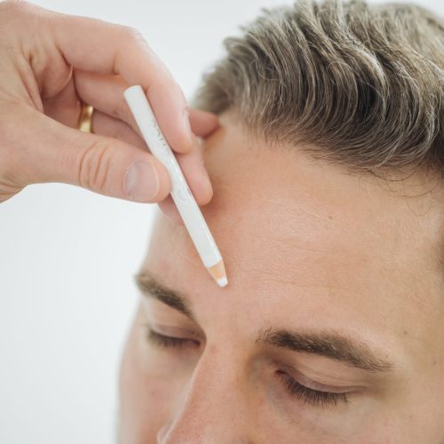 Eine Person markiert mit einem weißen Bleistift eine Stelle auf der Stirn eines Mannes, der die Augen geschlossen hat und sich möglicherweise auf einen kosmetischen oder medizinischen Eingriff vorbereitet.